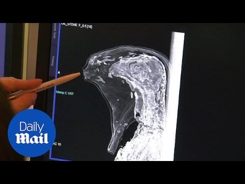CT scan of 3,000-year-old Ancient Egypt mummy show it represents god Osiris