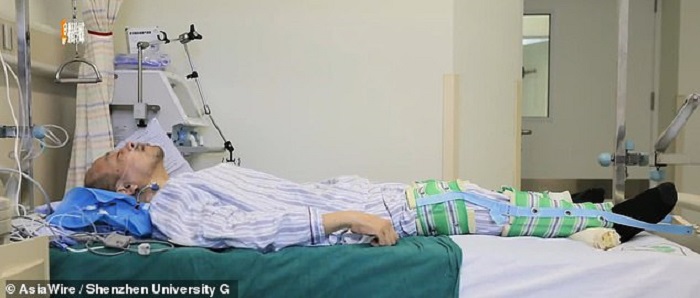 1576956764 692 A 20 year old Chinese resident has been reeling on two ankylosing