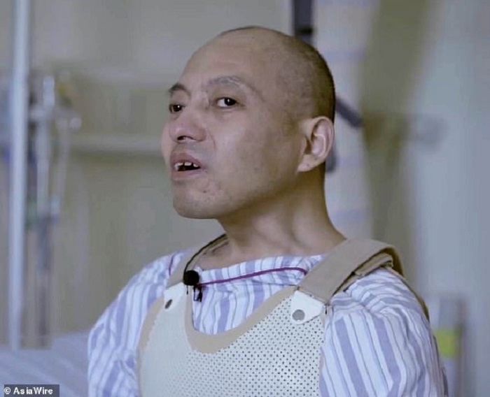 1576956766 881 A 20 year old Chinese resident has been reeling on two ankylosing