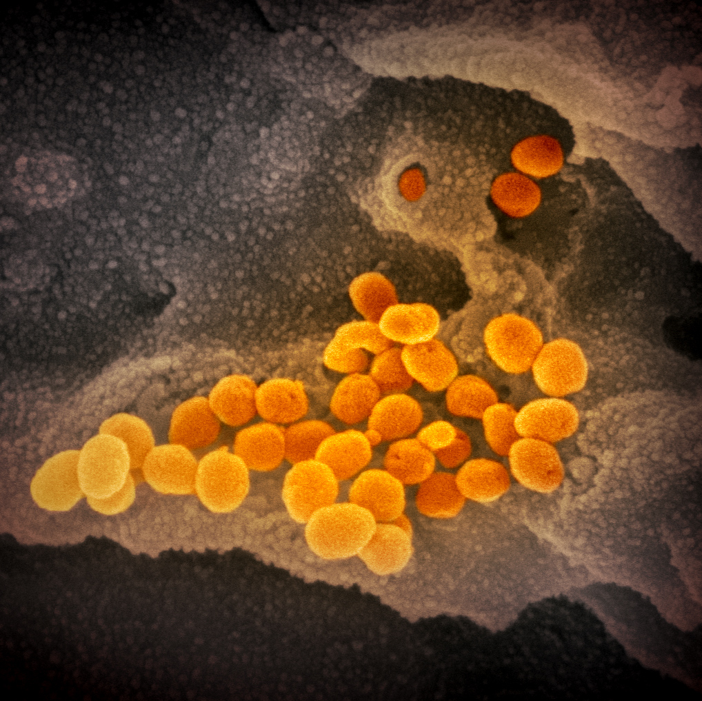 1581687505 268 New images of the Covid 19 virus published under the microscope