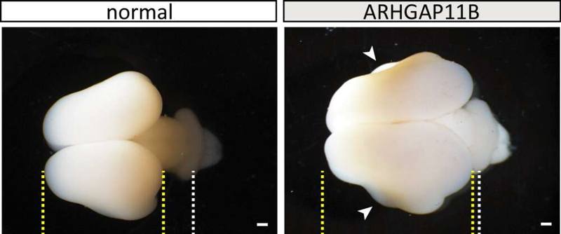 Scientists have developed larger monkey brains with human genes