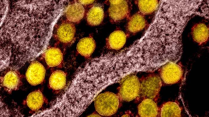 Scientists find a mysterious gene hidden within another gene in the SARS-CoV-2 virus 37 Scientists find a mysterious gene hidden within another gene in the SARS-CoV-2 virus 34