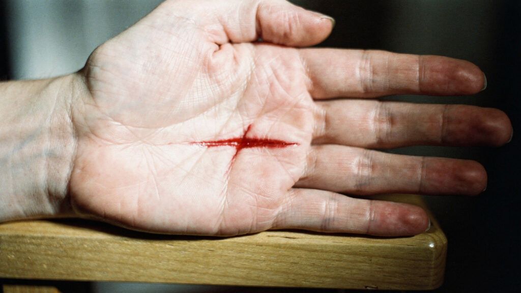 the akita protocol stigmata 1